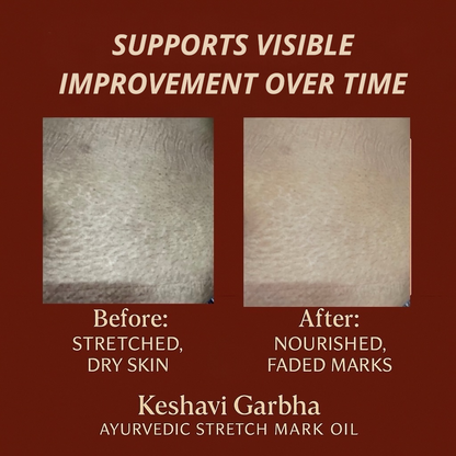 Keshavi Garbh Sneha — Ritual Body Care for Stretch Marks & Skin Renewal
